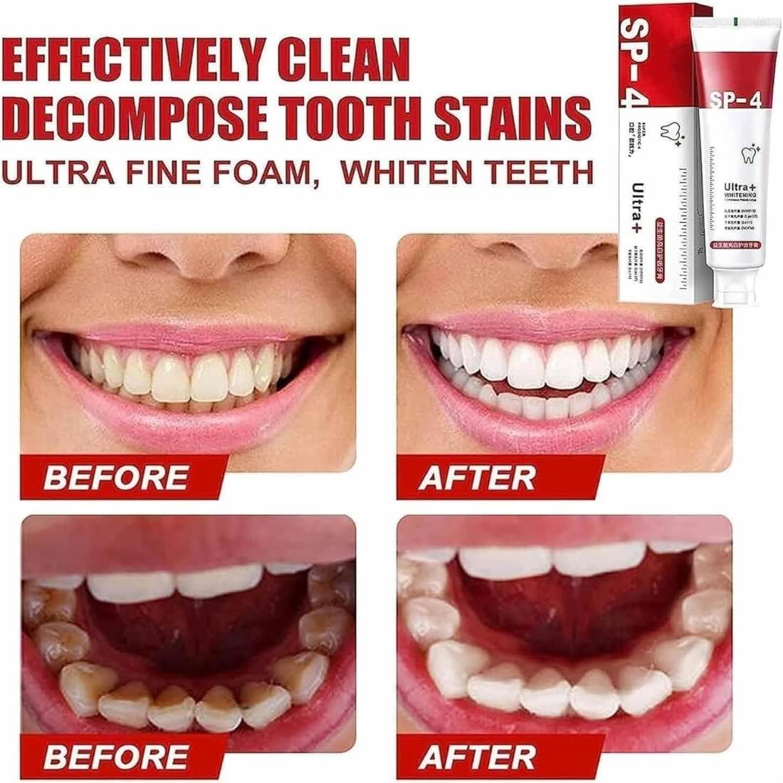 Yayashi SP-4 Ultra Whitening Toothpaste | Stain Remover & Fresh Breath Formula